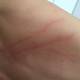 graffi schiena ragazzo