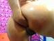 anal fisting